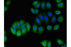 Immunofluorescent analysis of A549 cells using ABIN7170798 at dilution of 1:100 and Alexa Fluor 488-congugated AffiniPure Goat Anti-Rabbit IgG(H+L) (STOML1 antibody  (AA 79-290))