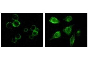 Immunofluorescence staining of methanol-fixed MCF-7 and HepG2 cells showing membrane and cytoplasmic localization. (TYRO3 antibody)