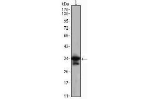 Western Blot showing CDC2 antibody used against Jurkat (1) cell lysate. (CDK1 antibody)