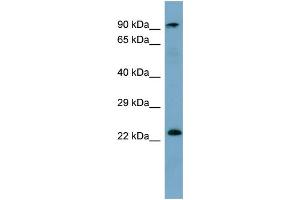 WB Suggested Anti-KRAS Antibody Titration: 0. (K-RAS antibody  (N-Term))