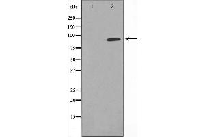 Western blot analysis on COLO cell lysate using CDK11 Antibody,The lane on the left is treated with the antigen-specific peptide. (CDK11 antibody  (Internal Region))