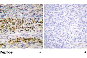Immunohistochemical analysis of paraffin-embedded human ovary tissue using NFKB1 polyclonal antibody . (NFKB1 antibody)