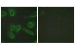 Immunofluorescence analysis of HeLa cells, using PECAM-1 (Ab-713) antibody. (CD31 antibody  (Tyr713))