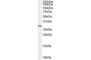 Western Blotting (WB) image for anti-Family with Sequence Similarity 107, Member B (FAM107B) (Middle Region) antibody (ABIN2156804) (FAM107B antibody  (Middle Region))
