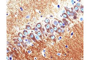 PKC epsilon (clone 21) staining on rat brain. (PKC epsilon antibody  (AA 1-175))