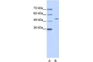 WB Suggested Anti-ZNF555 Antibody Titration:  0. (ZNF555 antibody  (N-Term))
