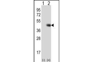 Western blot analysis of TPST1 (arrow) using rabbit polyclonal TPST1 Antibody  (ABIN650705 and ABIN2839242). (TPST1 antibody  (C-Term))