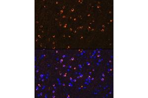Immunofluorescence analysis of mouse brain using NMD Rabbit mAb (ABIN7267417) at dilution of 1:100 (40x lens). (GRIN1/NMDAR1 antibody)