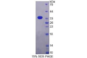 SDS-PAGE analysis of Rat AZIN1 Protein. (Antizyme Inhibitor 1 Protein (AZIN1))