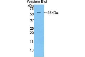 Western Blotting (WB) image for anti-Myxovirus Resistance Protein 1 (MX1) (AA 400-652) antibody (ABIN1859914) (MX1 antibody  (AA 400-652))