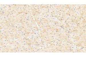 Detection of MYLK3 in Human Cardiac Muscle Tissue using Polyclonal Antibody to Myosin Light Chain Kinase 3 (MYLK3) (MYLK3 antibody  (AA 555-786))