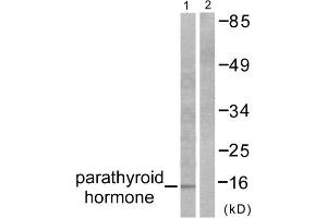 Western blot analysis of extracts from A549 cells, using Parathyroid Hormone antibody (ABIN5976482). (PTH antibody  (Internal Region))