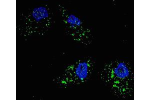 Immunofluorescence (IF) image for anti-Sequestosome 1 (SQSTM1) (AA 317-346) antibody (ABIN388979)