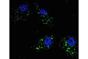 Fluorescent image of  cells stained with SQSTM1 (p62) (C-term) antibody. (SQSTM1 antibody  (AA 317-346))