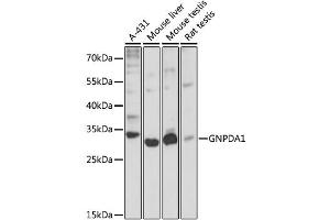 Western blot analysis of extracts of various cell lines, using GNPDA1 antibody (ABIN6292107) at 1:3000 dilution. (GNPDA1 antibody)