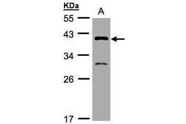 GIPC3 Antikörper  (N-Term)