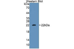 Detection of Recombinant GCDH, Human using Polyclonal Antibody to Glutaryl Coenzyme A Dehydrogenase (GCDH) (GCDH antibody  (AA 270-438))