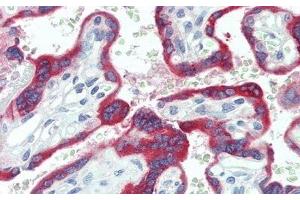 Detection of TFPI2 in Human Placenta Tissue using Polyclonal Antibody to Tissue Factor Pathway Inhibitor 2 (TFPI2) (TFPI2 antibody  (AA 23-235))