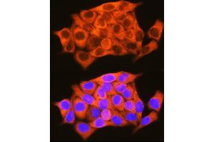 Immunofluorescence (IF) image for anti-Retinol Binding Protein 1, Cellular (RBP1) (AA 63-197) antibody (ABIN6146795)