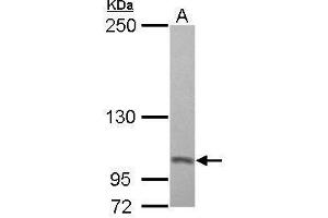 WB Image Sample (30 ug of whole cell lysate) A: A431 5% SDS PAGE antibody diluted at 1:500 (PSMD2 antibody)