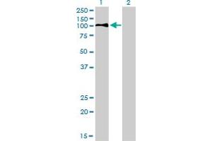 Western Blot analysis of LDLR expression in transfected 293T cell line by LDLR monoclonal antibody (M01), clone 5E7. (LDLR antibody  (AA 105-205))