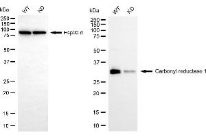 Western blotting analysis using carbonyl reductase 1 antibody (ABIN7797873). (CBR1 antibody)
