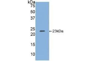 Detection of Recombinant HSPG, Human using Polyclonal Antibody to Heparan Sulfate Proteoglycan (HSPG) (HSPG antibody  (AA 19-144))