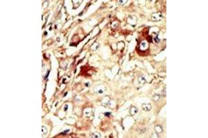 Image no. 2 for anti-WEE1 Homolog (S. Pombe) (WEE1) (Middle Region) antibody (ABIN360580)