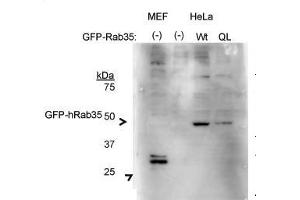 Human; RAB35 antibody - middle region validated by WB using HeLa cells, HEK293T cells at 1:500. (RAB35 antibody  (Middle Region))