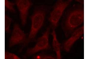 Immunofluorescence staining of methanol-fixed HeLa cells using CARM1 (Phospho-Ser228) antibody. (CARM1 antibody  (pSer228))