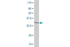 Western Blot detection against Immunogen (36. (IRAK2 antibody  (AA 111-210))