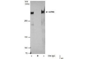 IP Image Immunoprecipitation of ATRX protein from 293T whole cell extracts using 5 μg of ATRX antibody [C3], C-term, Western blot analysis was performed using ATRX antibody [C3], C-term, EasyBlot anti-Rabbit IgG  was used as a secondary reagent.
