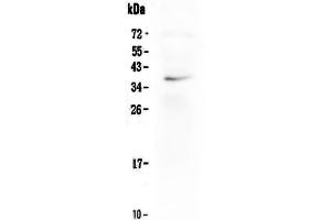 Western blot analysis of LOX-1/OLR1 using anti-LOX-1/OLR1 antibody .