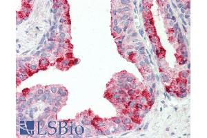ABIN1781957 (5µg/ml) staining of paraffin embedded Human Prostate. (CUTA antibody  (C-Term))