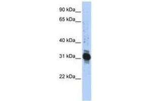 Image no. 1 for anti-Zinc Finger, AN1-Type Domain 3 (ZFAND3) (AA 72-121) antibody (ABIN6742474) (ZFAND3 antibody  (AA 72-121))