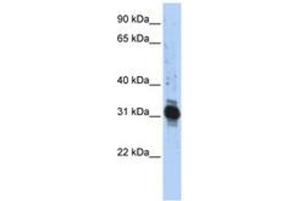 ZFAND3 antibody  (AA 72-121)