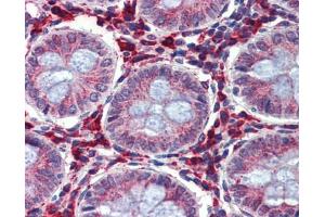Immunohistochemistry (IHC) image for anti-Insulin-Like Growth Factor Binding Protein 4 (IGFBP4) (Middle Region) antibody (ABIN2782316) (IGFBP4 antibody  (Middle Region))