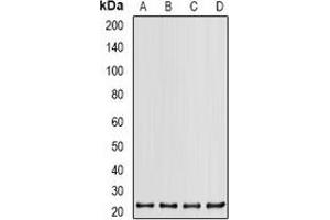 Western blot analysis of PSMB2 expression in K562 (A), HT29 (B), Hela (C), 22RV1 (D) whole cell lysates.