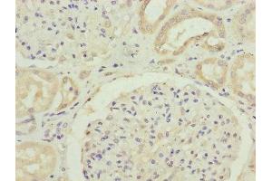Immunohistochemistry of paraffin-embedded human kidney tissue using ABIN7152413 at dilution of 1:100 (FBXO24 antibody  (AA 1-200))