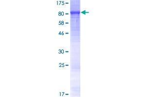 LRRC40 Protein (AA 1-602) (GST tag)