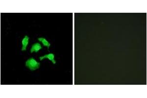 Immunofluorescence analysis of HepG2 cells, using TSC22D1 Antibody. (TSC22D1 antibody  (AA 71-120))