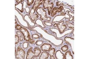 Immunohistochemical staining of human kidney with ZNF234 polyclonal antibody  shows strong cytoplasmic positivity in renal tubules.