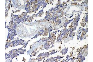 IHC analysis of Dnmt1 using anti-Dnmt1 antibody . (DNMT1 antibody  (AA 22-126))