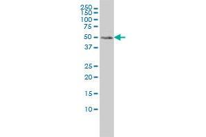 Western Blotting (WB) image for anti-Meis Homeobox 2 (MEIS2) (AA 1-382) antibody (ABIN598810) (MEIS2 antibody  (AA 1-382))