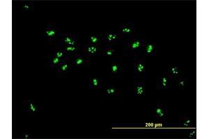 Immunofluorescence of purified MaxPab antibody to LYAR on HeLa cell.