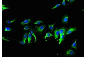 Immunofluorescent analysis of Hela cells using ABIN7173191 at dilution of 1:100 and Alexa Fluor 488-congugated AffiniPure Goat Anti-Rabbit IgG(H+L) (TMEM267 antibody  (AA 1-76))