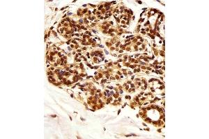 Immunohistochemical analysis of paraffin-embedded H. (PIN1 antibody)