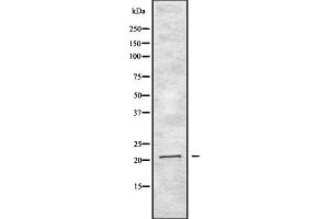 Western blot analysis of IFNA2 expression in HEK293 cells ,The lane on the left is treated with the antigen-specific peptide. (IFNA2 antibody  (N-Term))