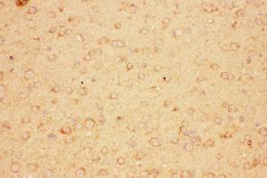 Anti-CNTF Picoband antibody,  IHC(P): Mouse Brain Tissue (CNTF antibody  (AA 2-200))