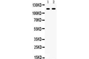 Anti- CD44 Picoband antibody, Western blotting All lanes: Anti CD44  at 0.